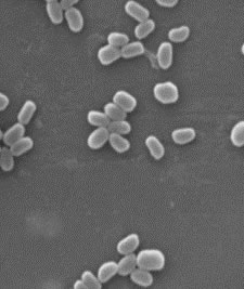 Schalenwicklergranulosvirus